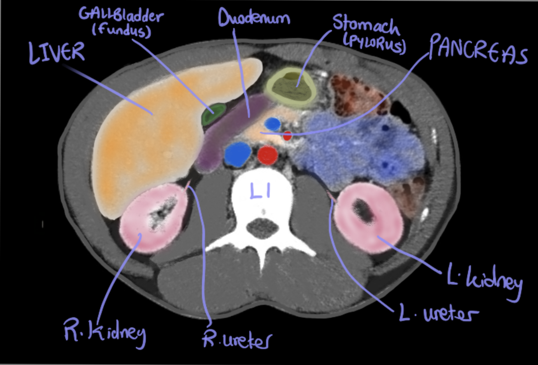 axial ct diagram of the transpyloric plane