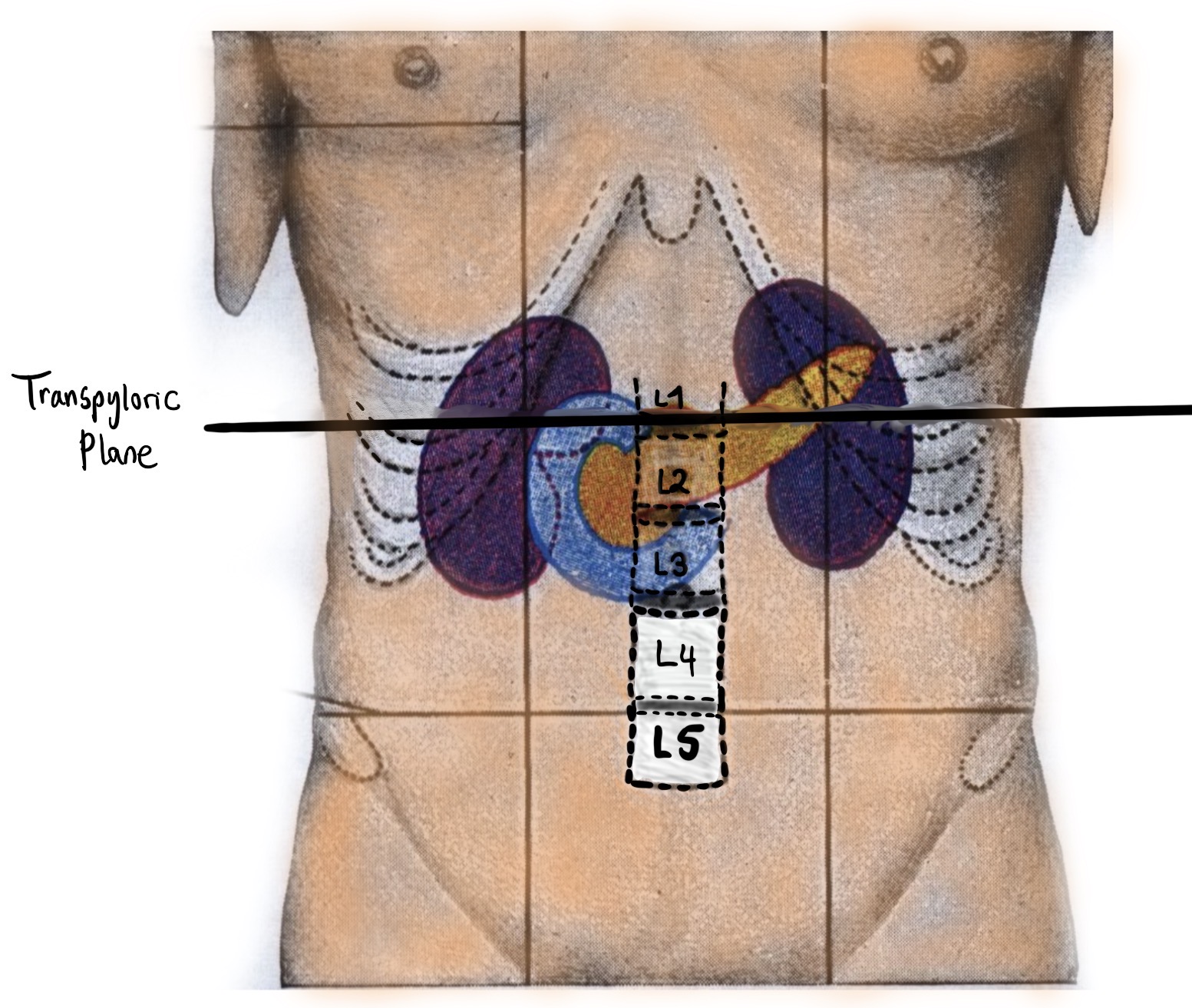 A diagram of the transpyloric plane