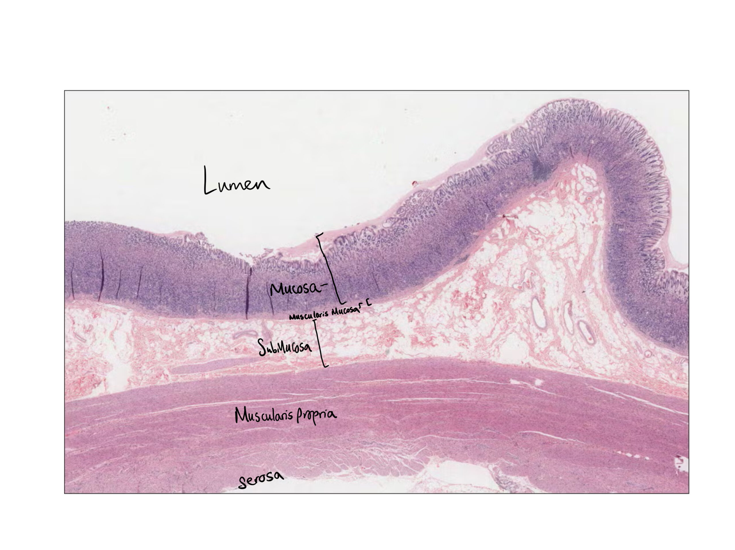 Gastric histology