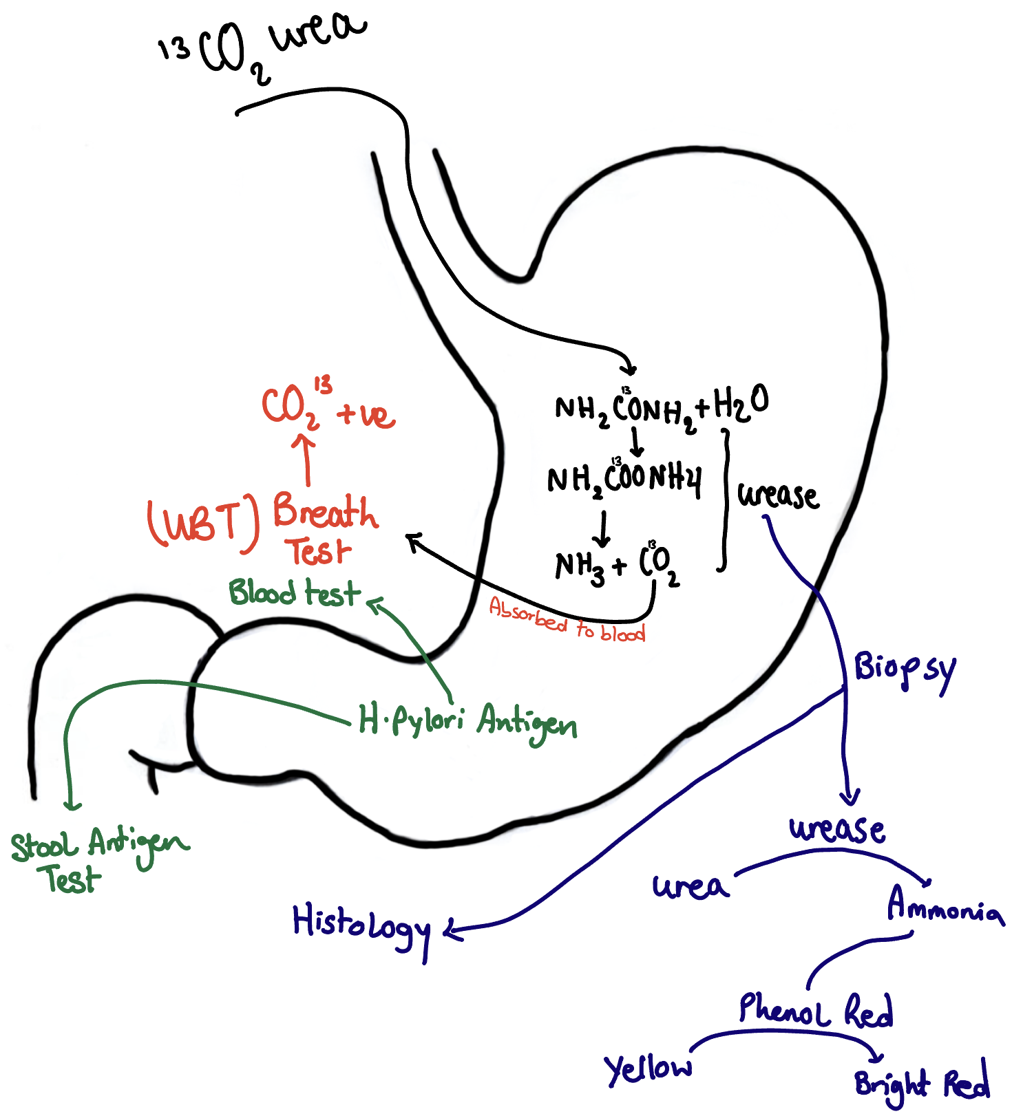 Summary of H.Pylori investigations