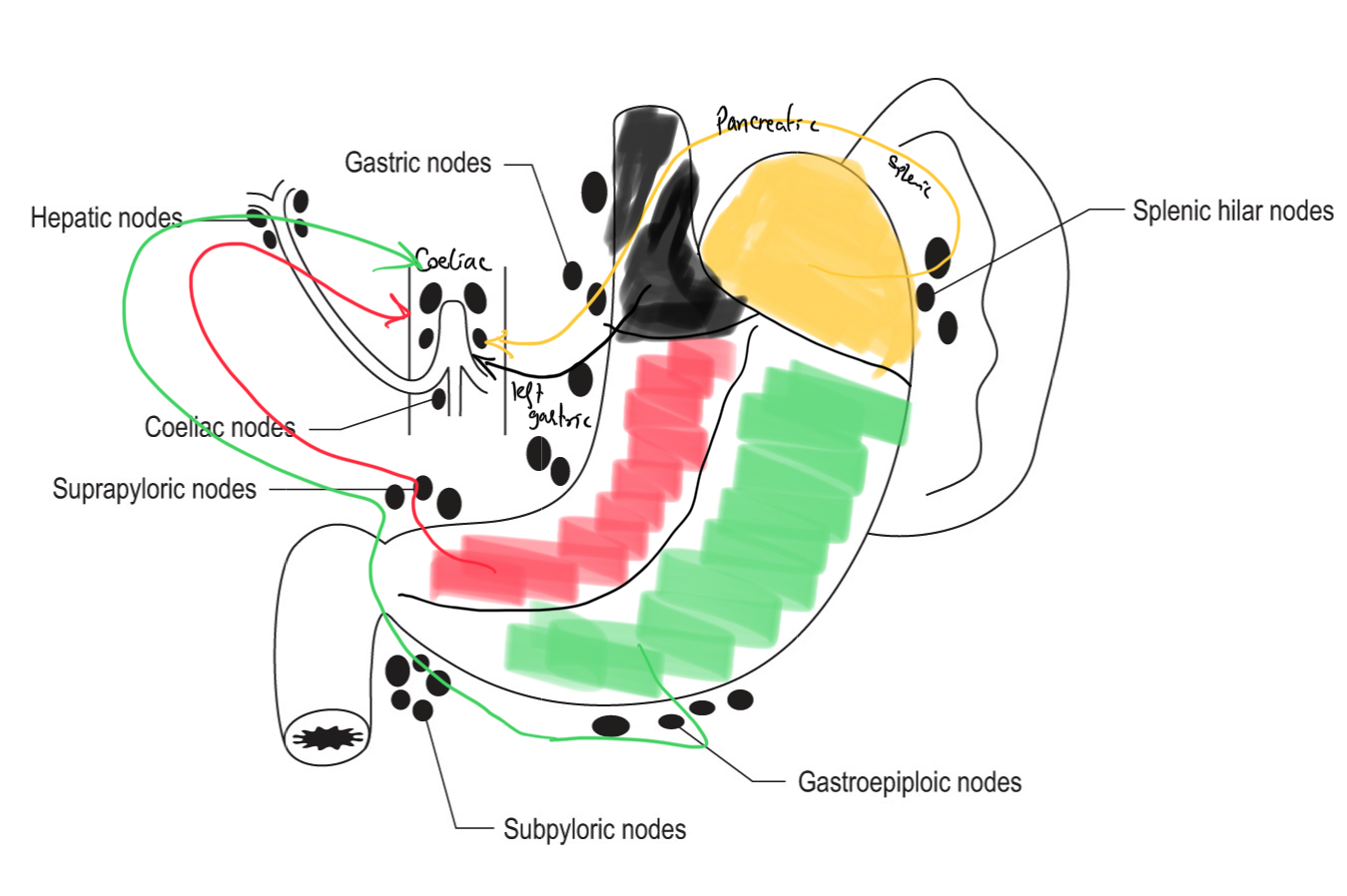 Lymph node distribution around the stomach
